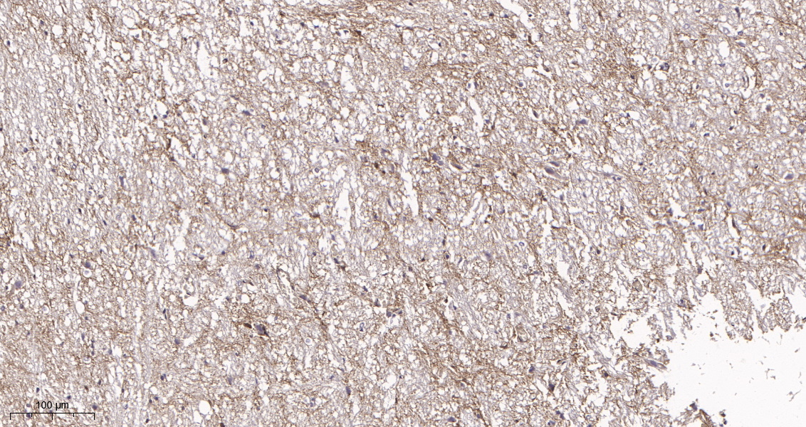 Rabbit Monoclonal Antibody to EAAT1