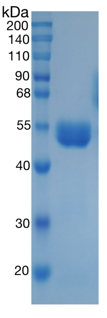 GX00069 Human Prorenin