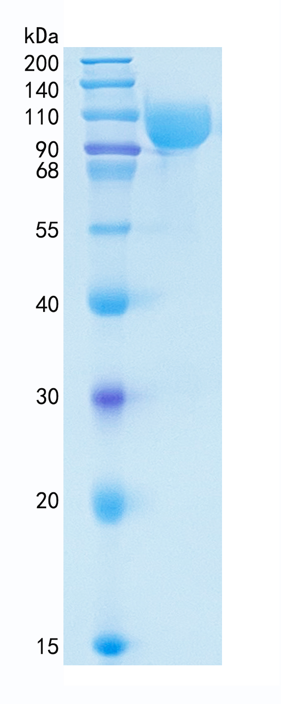 GX00110 Human Serpin G1 GX00110 Human Serpin G1