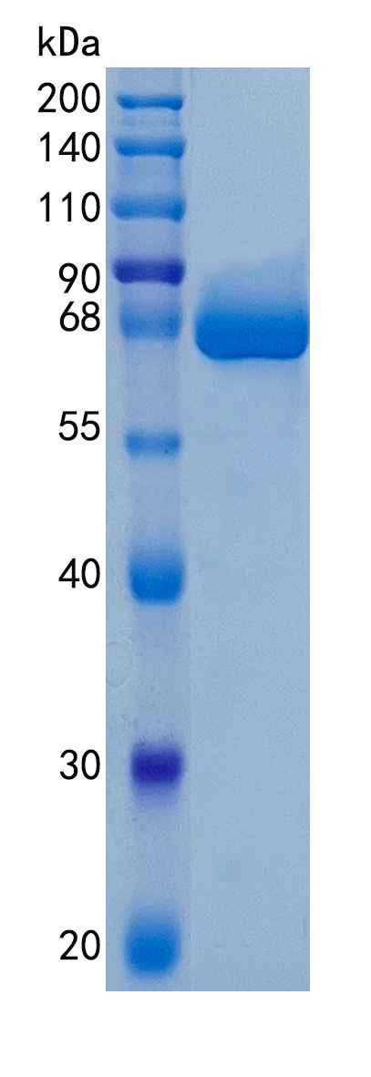 GX00111 Human ALPL GX00111 Human ALPL