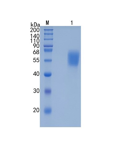 GX00130 Human Cortisol Binding Globulin