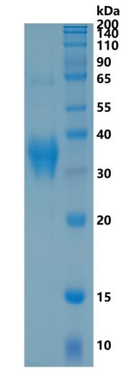 GX00161 Human Clusterin