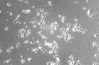 GX00161 Human Clusterin At