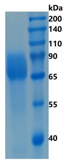 GX00162 Human Growth hormone Receptor