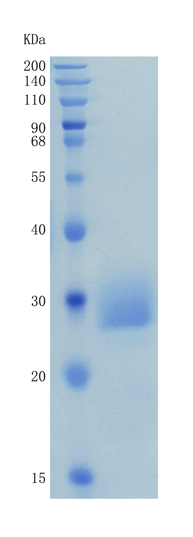 GX00170 Human FCGR2A