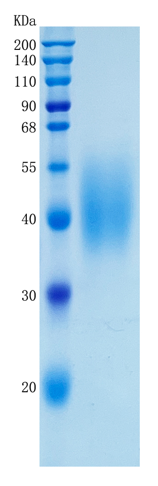 GX00171 Human FCER1A