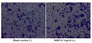 GX00186 Human MMP9 At