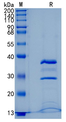 GX00251 Human Cathepsin S