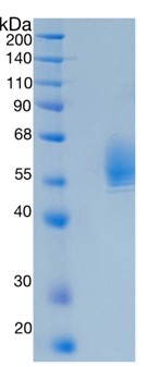 GX00274 Human SerpinB3