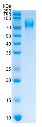 GX00302 Human Thrombopoietin