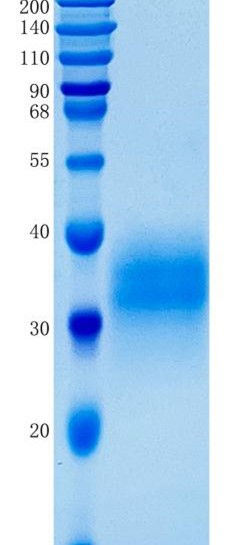 GX00341 Human Ephrin B2