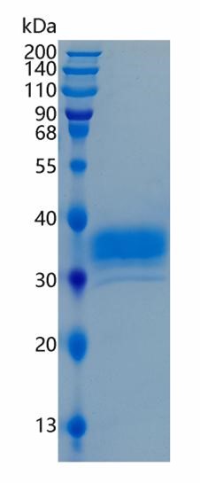 GX00411 Human BTN1A1