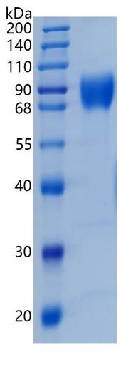 GX00416 Human IL10 R alpha
