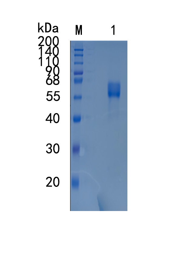 GX00417 Human Activin RIIB
