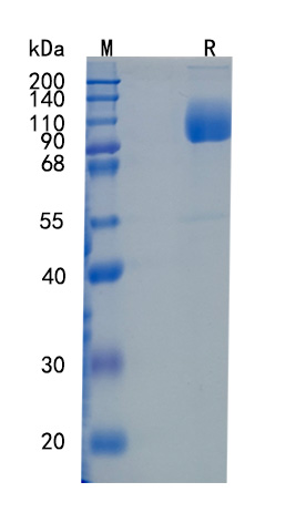 GX00421 Human LIMPII