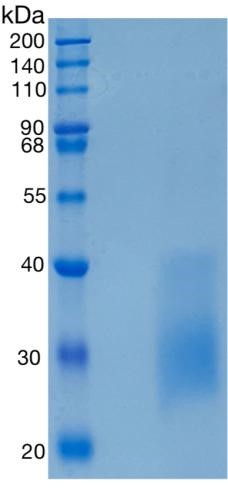 GX00536 Human TNFRSF14