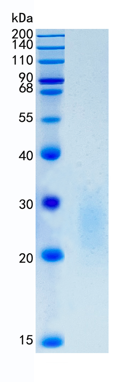 GX00543 Human TMIGD2