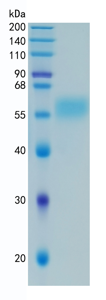 GX00655 Human IL18RB