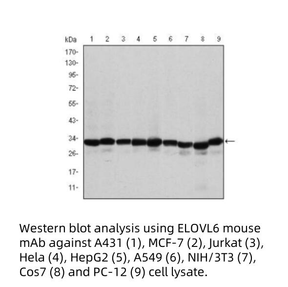 238508d80f6fb54eaf5e2ee3af0ab10b