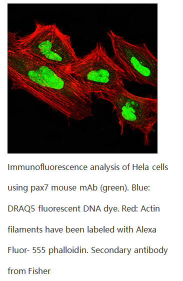 145b1e1c0dd7271dd53f9b8ae9d9fd1