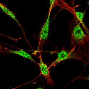 b48bab93cfa78dd1c3fe2683288bbcc5_a496c58a86b39659c6193795e4862876